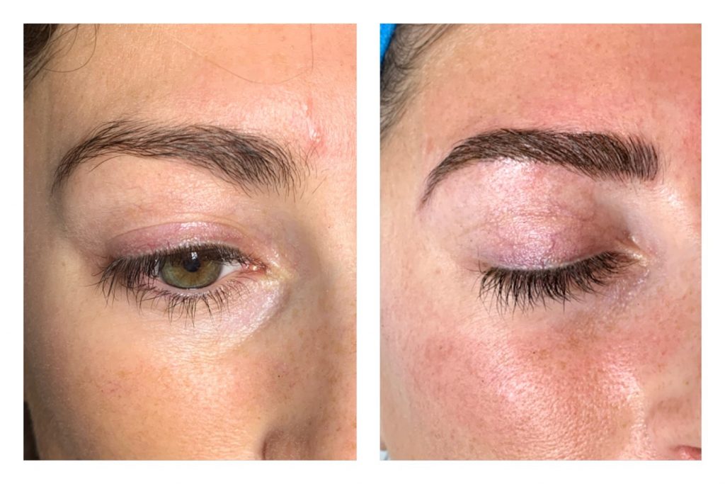 The Rx Beauty Studio Troy New York Microblading